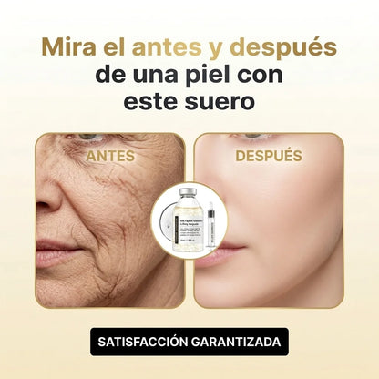 Suero Facial Efecto Lifting para Piel Más Firme y Rejuvenecida
